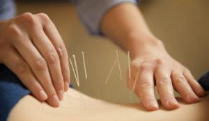 Acupuncture and the Pelvic Floor