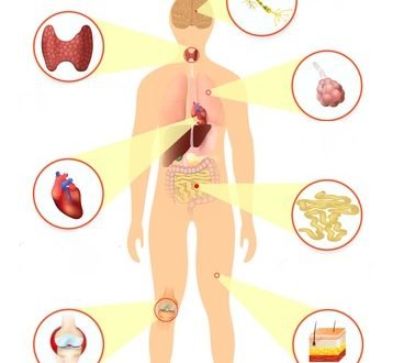 How acupuncture helps manage chronic conditions